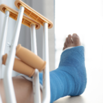 Person in a leg cast with leg up